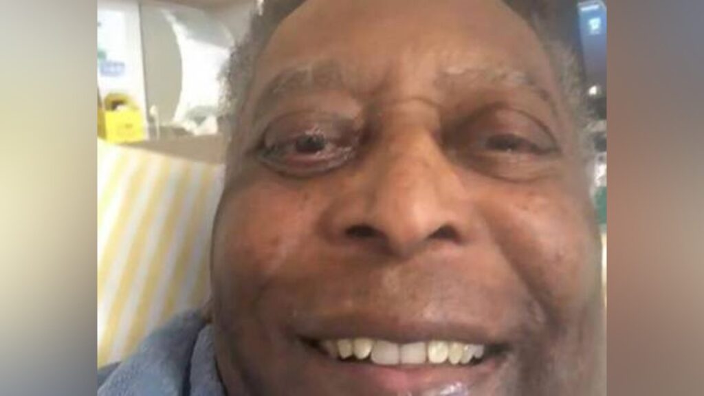 Filha posta foto de Pelé e diz que ele está pronto para sair da UTI
