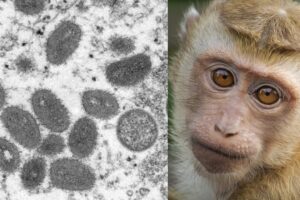 Varíola dos macacos faz brasileiros buscarem vacina