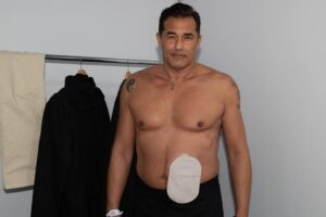 Luciano Szafir segue internado após cirurgia para retirar colostomia