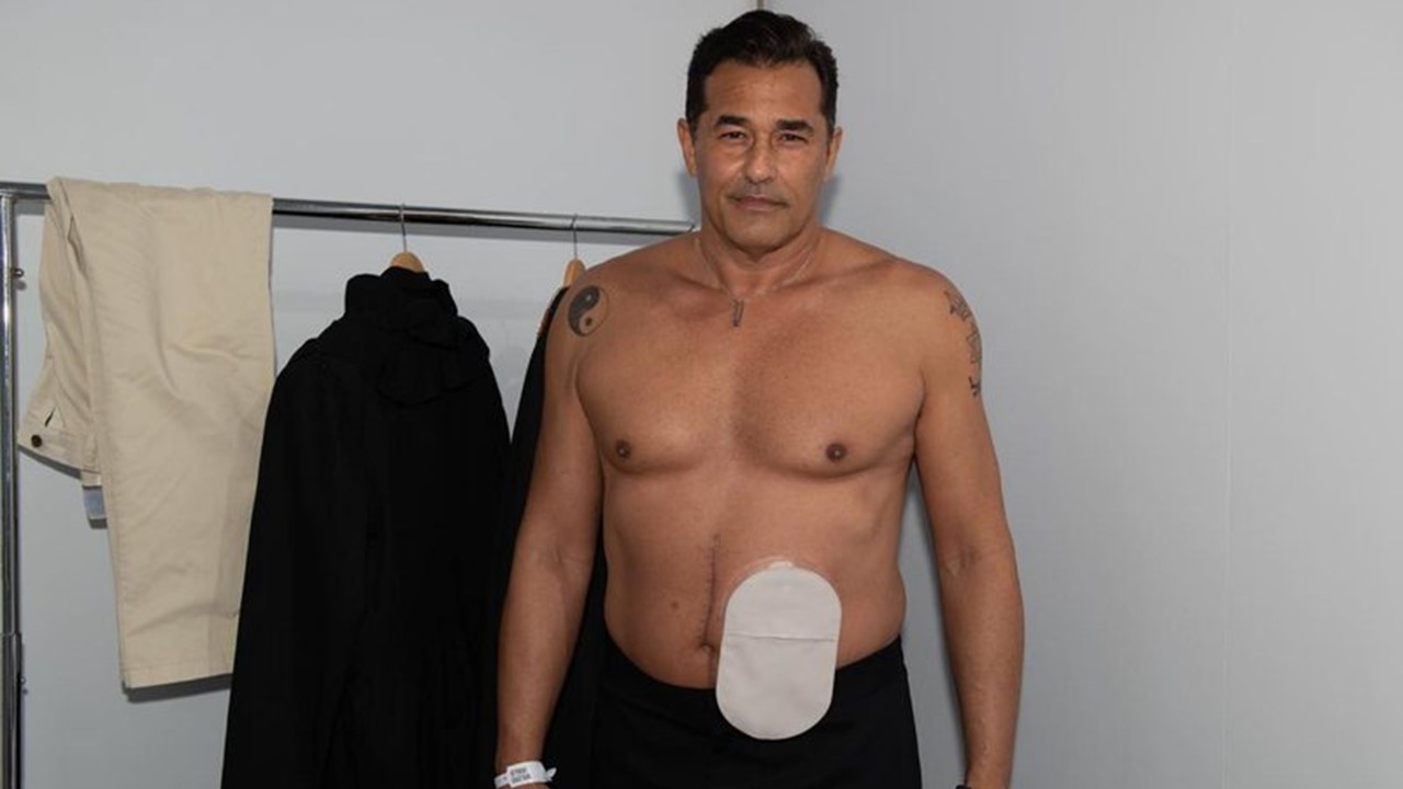 Luciano Szafir segue internado após cirurgia para retirar colostomia