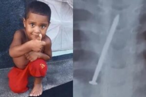 Menino de três anos morre com prego no pulmão