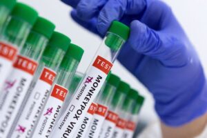 Campinas confirma mais seis casos de varíola dos macacos