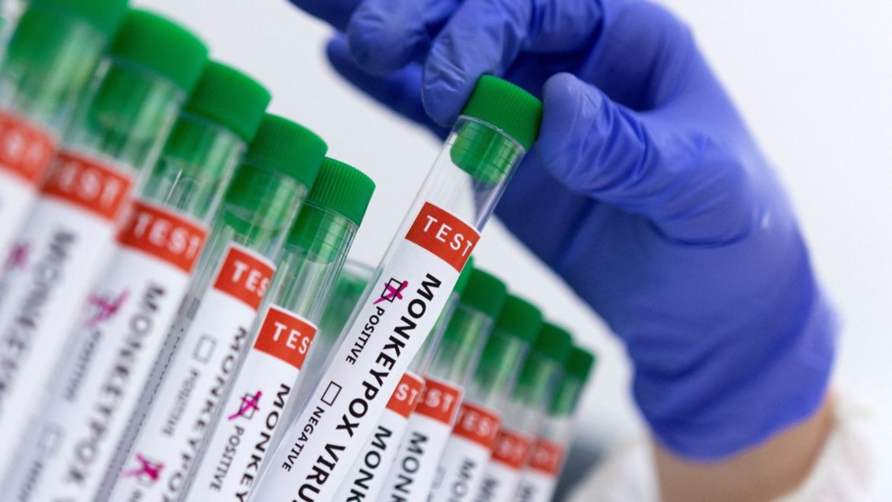 Campinas confirma mais seis casos de varíola dos macacos