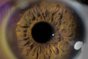 Prevenção e Diagnóstico Precoce: Chaves para Combater o Glaucoma. Glaucoma, a doença silenciosa, é a segunda maior causa de cegueira irreversível no mundo